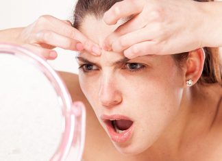 TIPS หน้าใส ไกลสิว