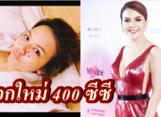 จ๊ะ บินไกลถึงเกาหลี อัปไซส์หน้าอก 400 ซีซี