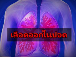 “เลือดออกในปอด” อาการตกเลือดเฉียบพลันจากปอด