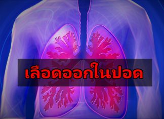 “เลือดออกในปอด” อาการตกเลือดเฉียบพลันจากปอด