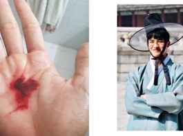 “เต ตะวัน” เตือนรักษาสุขภาพ ย้ำ!ใส่หน้ากากอนามัย หลังตนไอเป็นเลือด