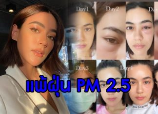 “คิมเบอร์ลี่” ตาบวมฉึ่ง เหตุจากฝุ่น PM 2.5 ทำพิษ!